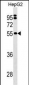 SEPSECS Antibody (C-term)